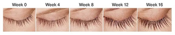 before and after latisse